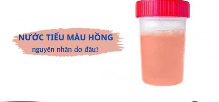 Nước tiểu có màu hồng: Nguyên nhân và cách xử lý