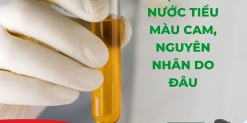 Nước tiểu màu cam: Dấu hiệu bình thường hay cảnh báo sức khỏe?