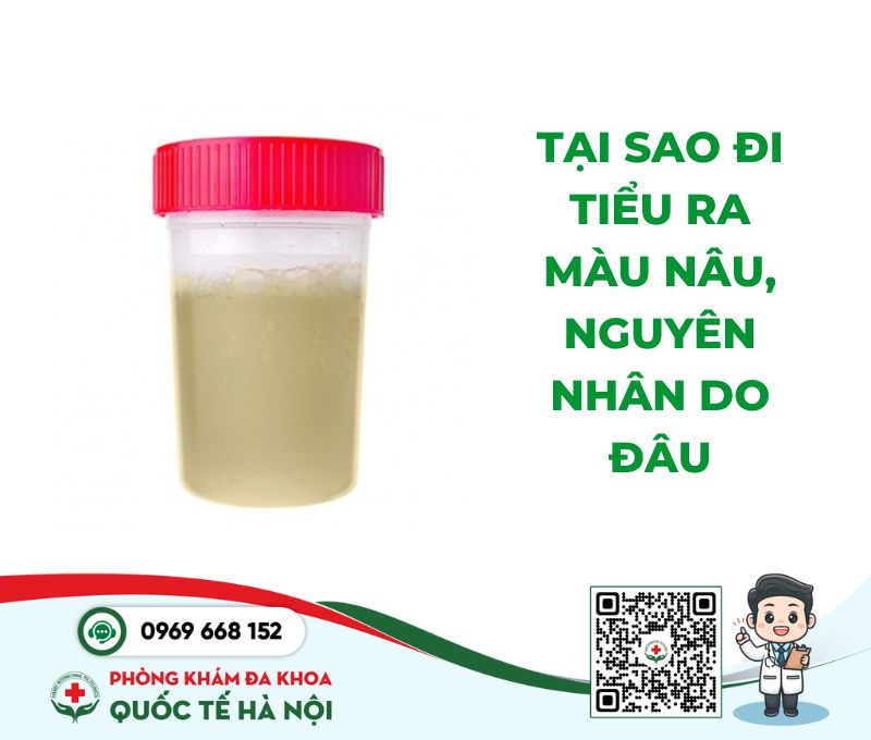 tại sao đi tiểu ra màu nâu, nguyên nhân do đâu